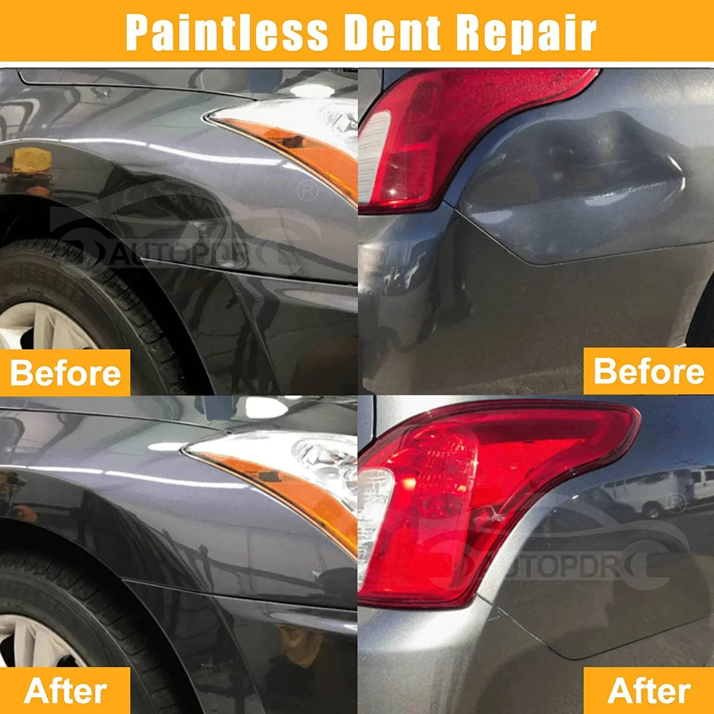 Car Dent Repair Kit – Professional Paintless Dent Removal Tools (Basic & Pro Set)