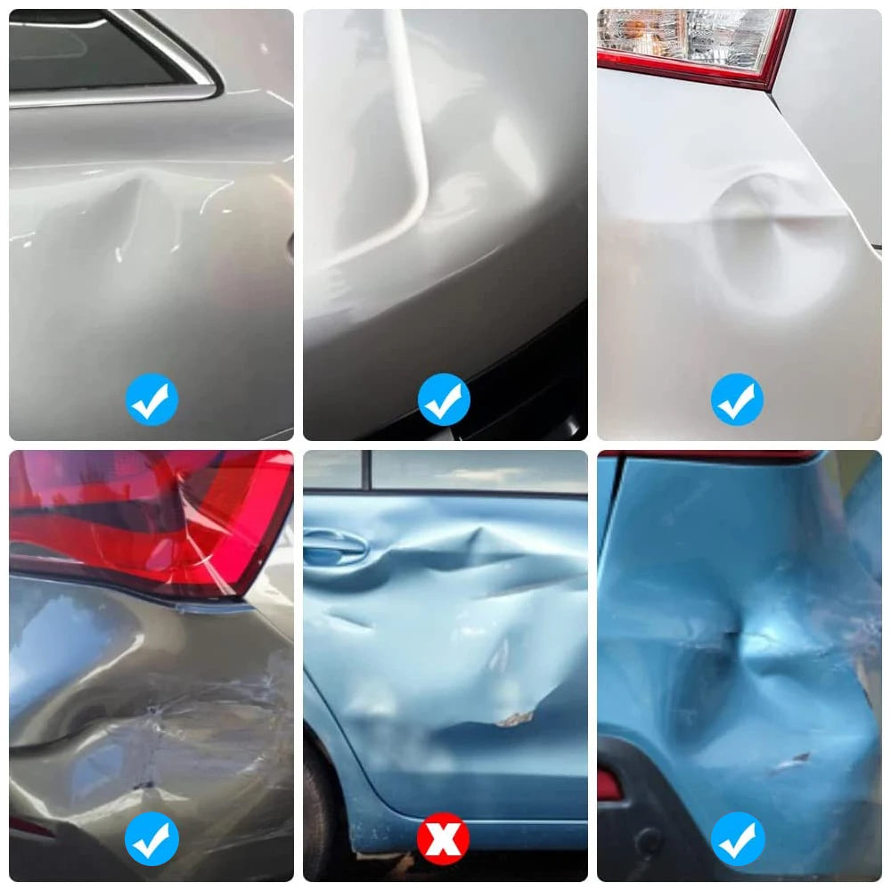 Car Dent Repair Kit – Professional Paintless Dent Removal Tools (Basic & Pro Set)