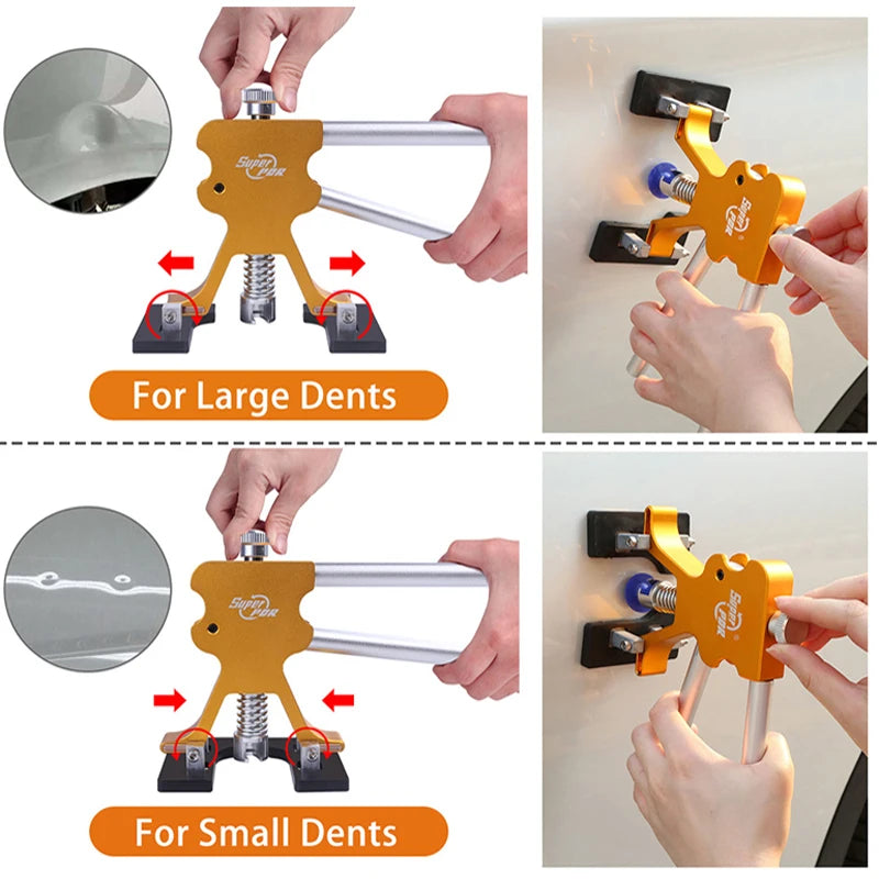 Car Dent Repair Kit – Professional Paintless Dent Removal Tools (Basic & Pro Set)