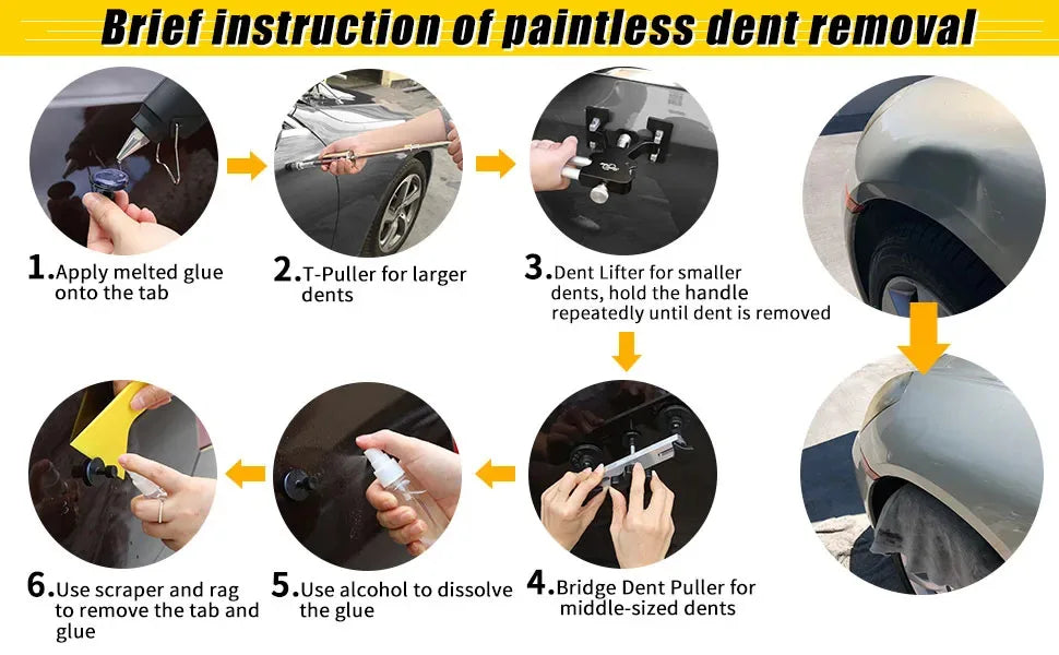 Car Dent Repair Kit – Professional Paintless Dent Removal Tools (Basic & Pro Set)