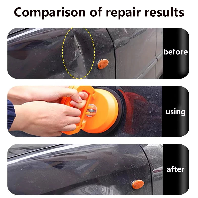 Car Dent Repair Kit – Professional Paintless Dent Removal Tools (Basic & Pro Set)